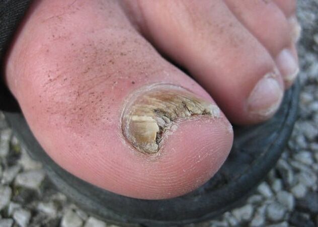 Резултатът от пренебрегване