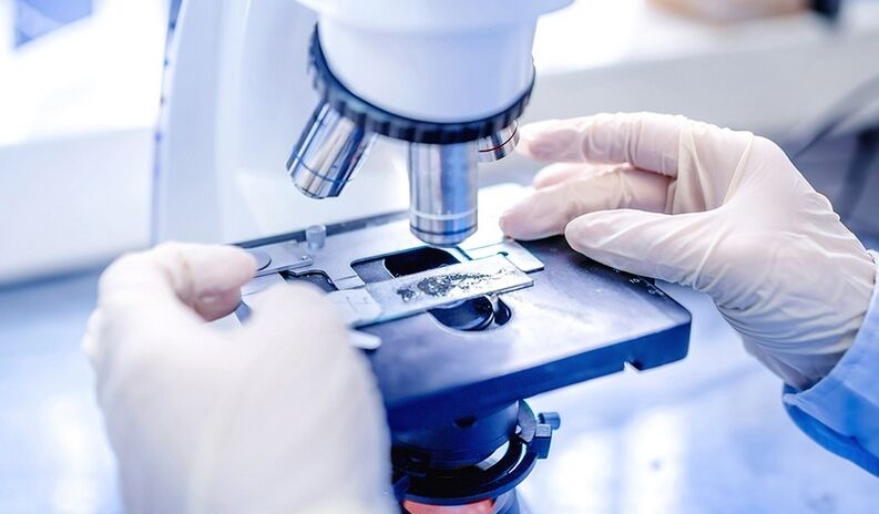 лабораторна диагностика на гъбички по ноктите на краката