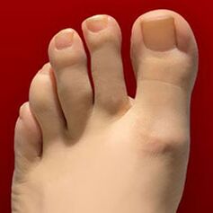 Гъбички за нокти