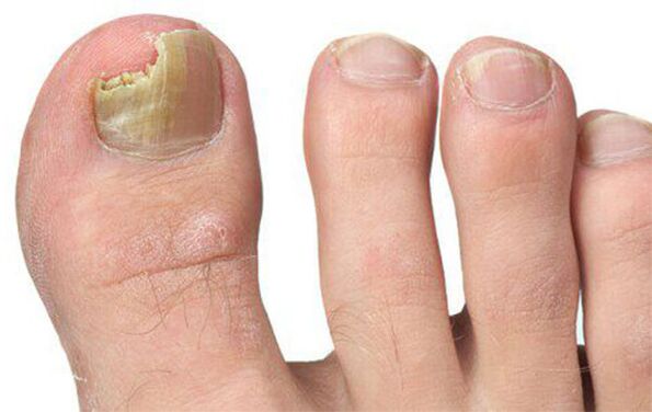 Различни форми на гъбички