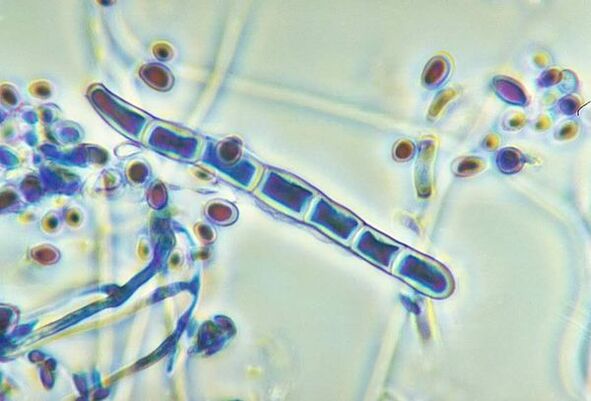 Гъбички Trichophyton rubrum под микроскоп